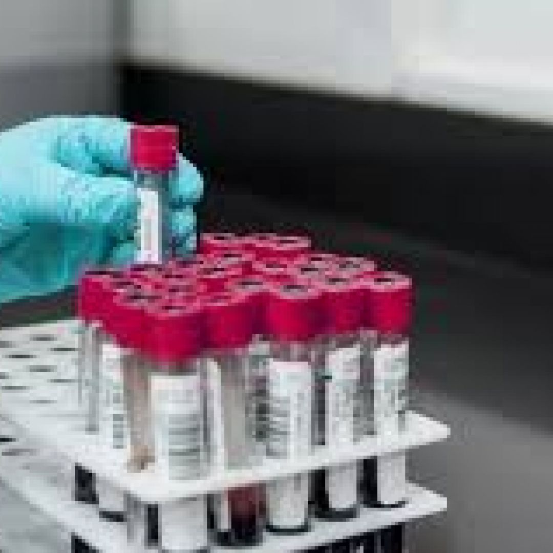 laboratorio-a-domicilio-25